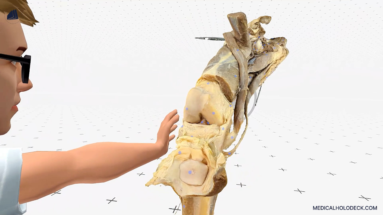 A virtual introduction into knee fractures thumbnail 2
