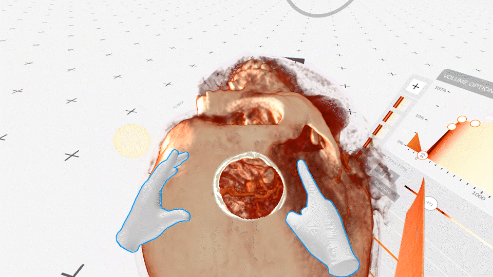 Teaching the next generation of neurosurgeons in virtual reality