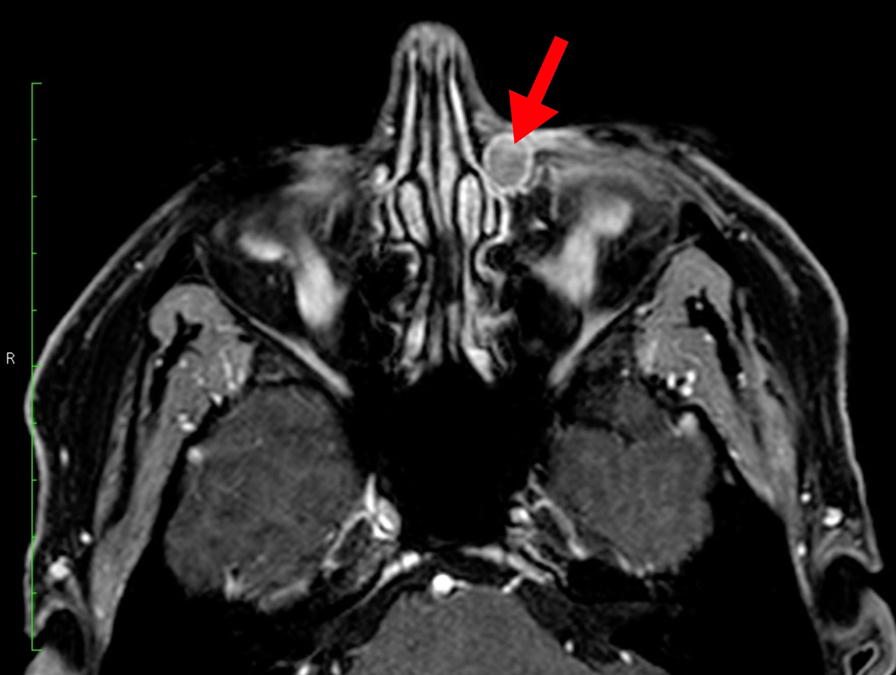 Article Header Image