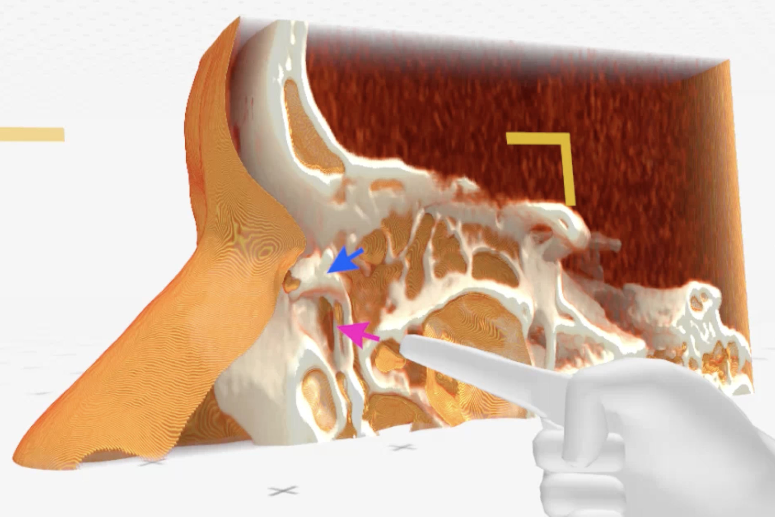 Article Header Image