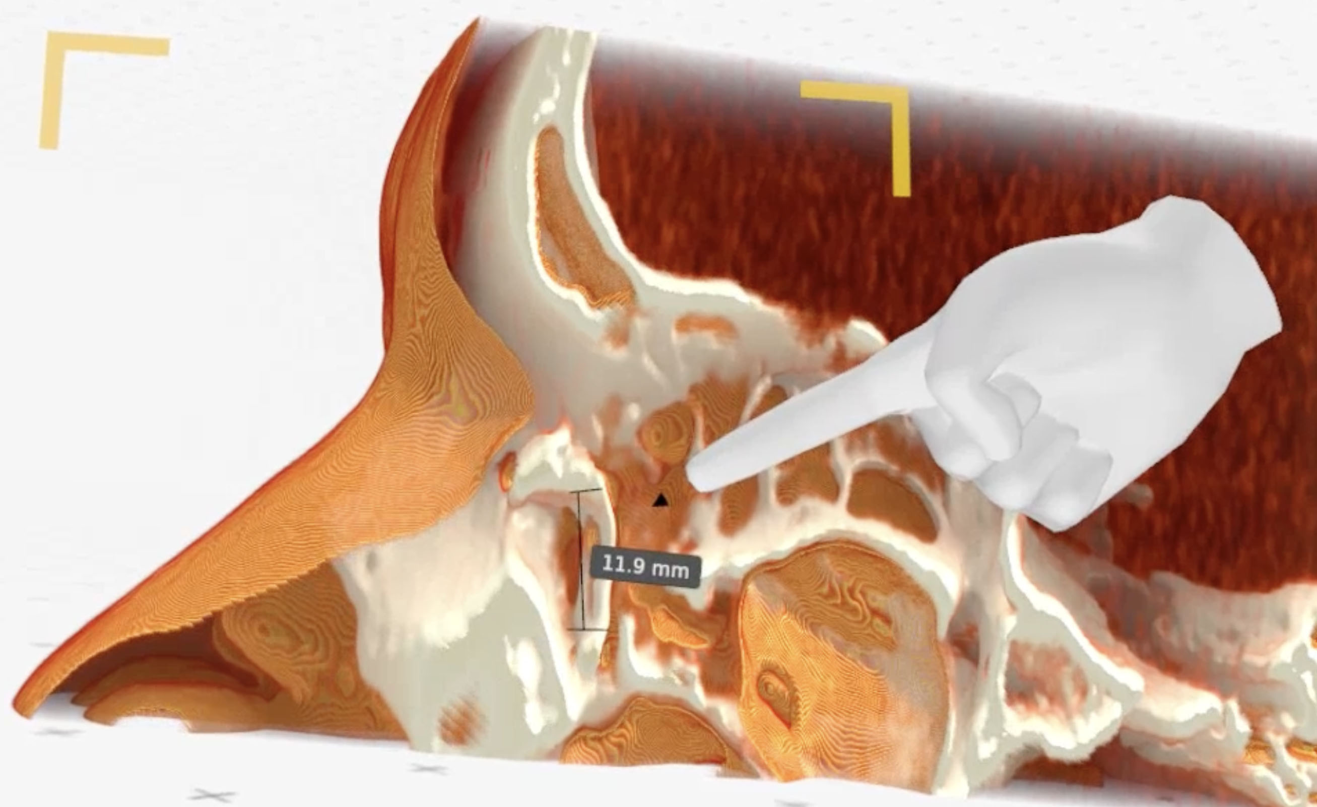 Article Header Image