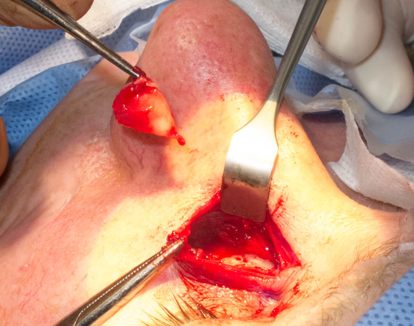 Article Header Image