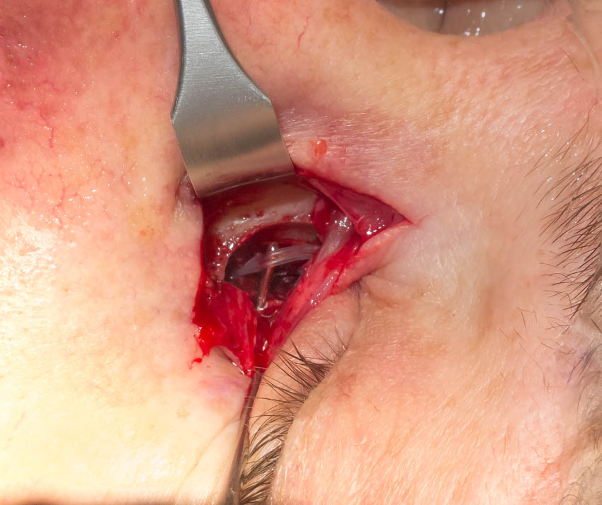 Article Header Image