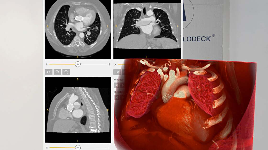 Why is spatial imaging replacing 2D imaging?