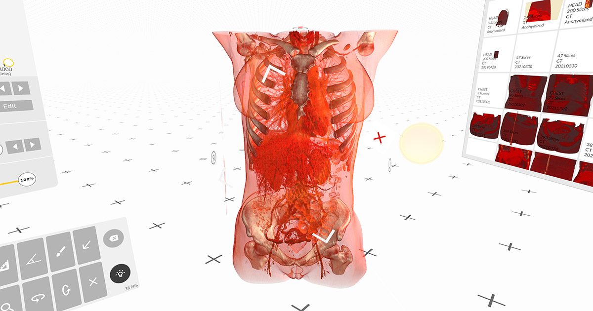 Virtual reality-based 3D reconstruction of chest imaging DICOM